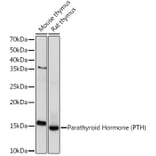 Western Blot - Anti-Parathyroid Hormone Antibody [ARC1709] (A307439) - Antibodies.com