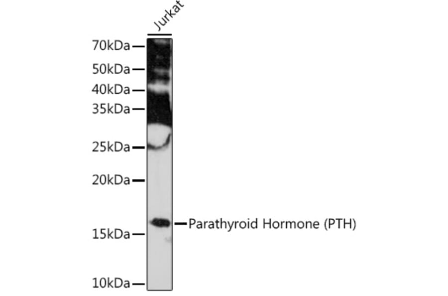 Western Blot - Anti-Parathyroid Hormone Antibody [ARC1709] (A307439) - Antibodies.com