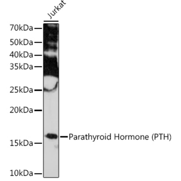 Western Blot - Anti-Parathyroid Hormone Antibody [ARC1709] (A307439) - Antibodies.com