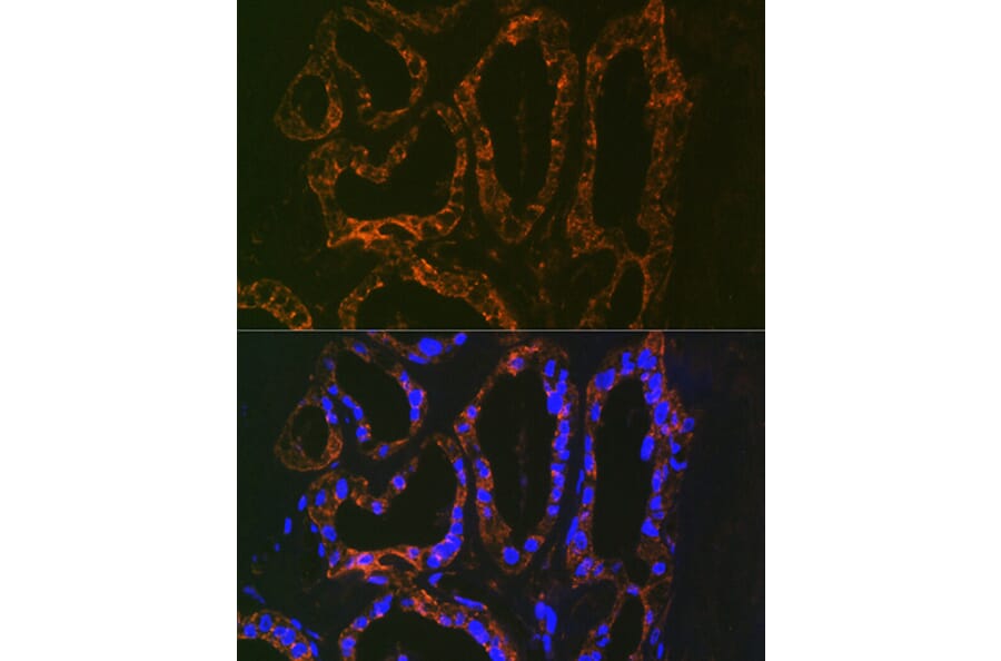 Immunofluorescence - Anti-Parathyroid Hormone Antibody [ARC1709] (A307439) - Antibodies.com