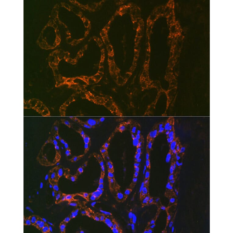 Immunofluorescence - Anti-Parathyroid Hormone Antibody [ARC1709] (A307439) - Antibodies.com