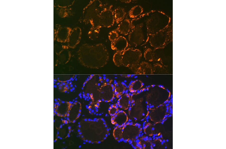 Immunofluorescence - Anti-Parathyroid Hormone Antibody [ARC1709] (A307439) - Antibodies.com