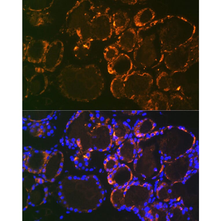 Immunofluorescence - Anti-Parathyroid Hormone Antibody [ARC1709] (A307439) - Antibodies.com