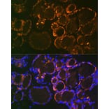 Immunofluorescence - Anti-Parathyroid Hormone Antibody [ARC1709] (A307439) - Antibodies.com