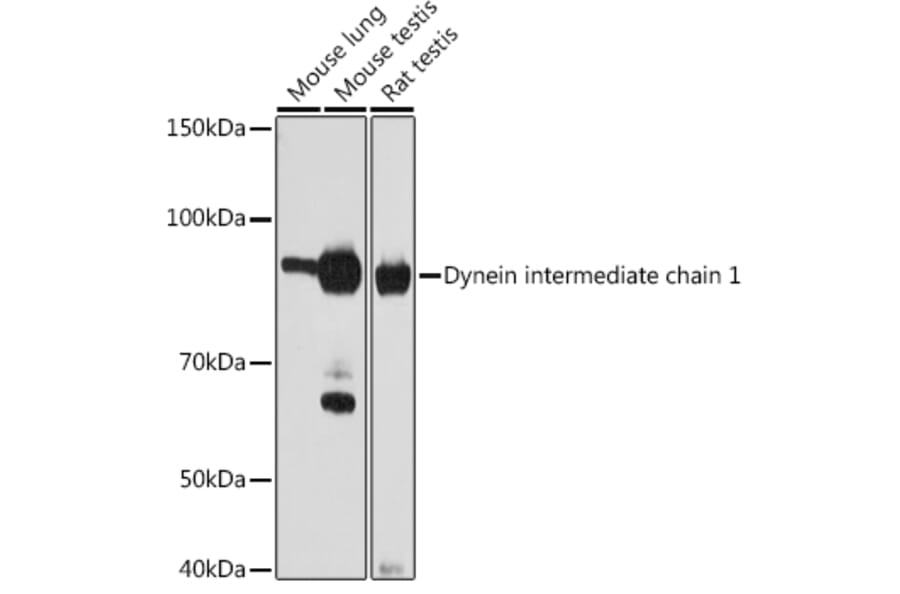 Western Blot - Anti-Dynein intermediate chain 1/DNAI1 Antibody [ARC2061] (A307440) - Antibodies.com