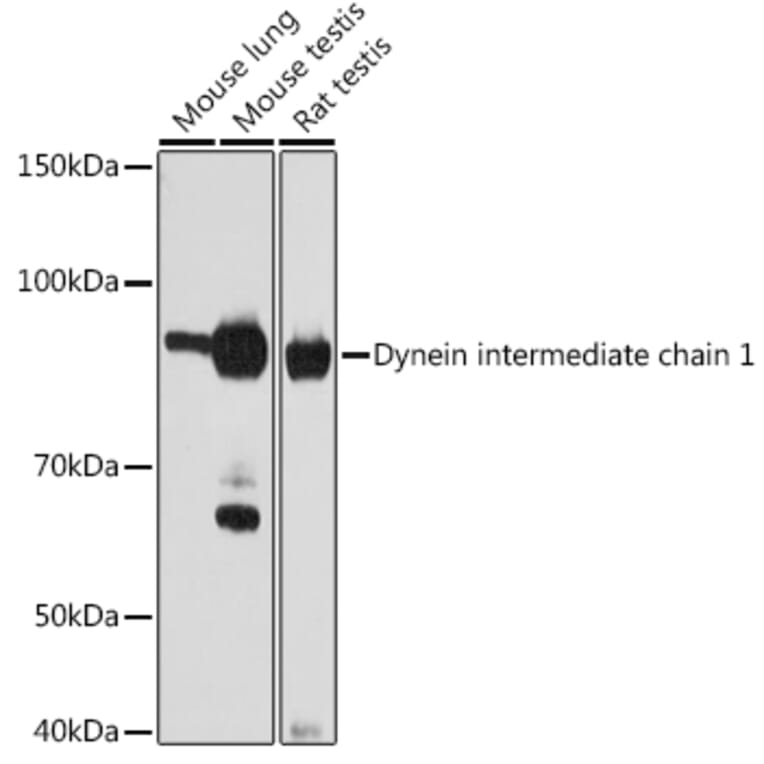 Western Blot - Anti-Dynein intermediate chain 1/DNAI1 Antibody [ARC2061] (A307440) - Antibodies.com