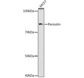 Western Blot - Anti-Periostin Antibody [ARC1380] (A307441) - Antibodies.com