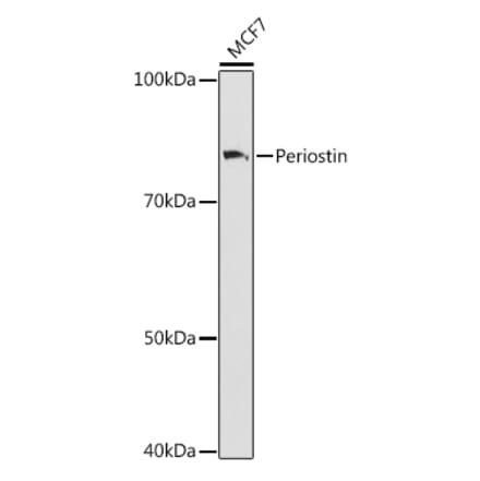 Western Blot - Anti-Periostin Antibody [ARC1380] (A307441) - Antibodies.com