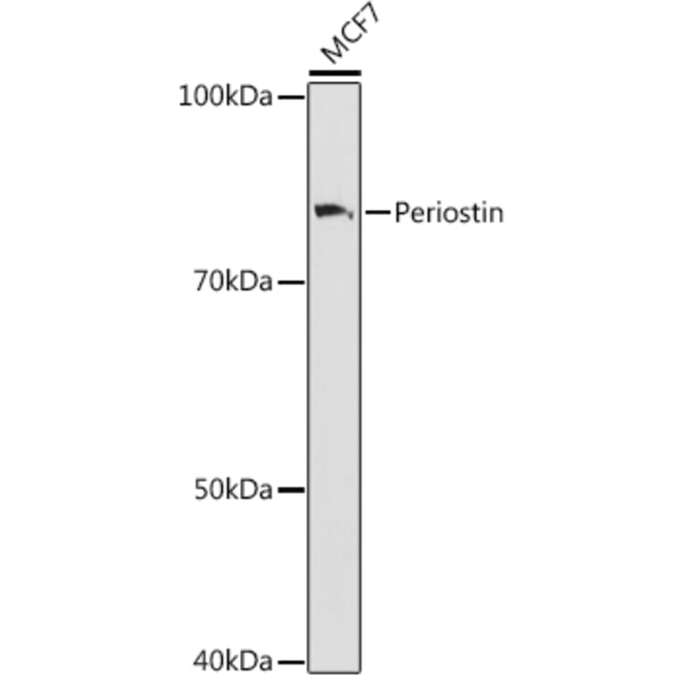 Western Blot - Anti-Periostin Antibody [ARC1380] (A307441) - Antibodies.com