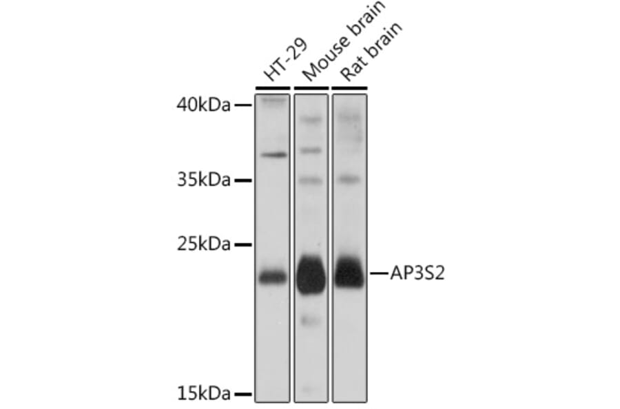 Western Blot - Anti-AP3S2 Antibody (A307442) - Antibodies.com