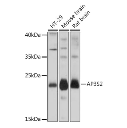 Western Blot - Anti-AP3S2 Antibody (A307442) - Antibodies.com