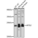 Western Blot - Anti-AP3S2 Antibody (A307442) - Antibodies.com