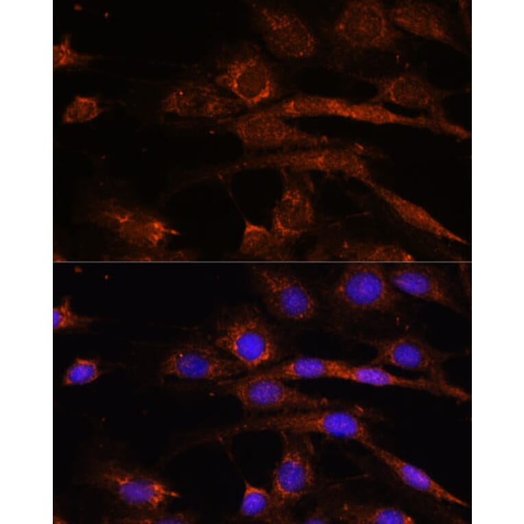 Immunofluorescence - Anti-AP3S2 Antibody (A307442) - Antibodies.com