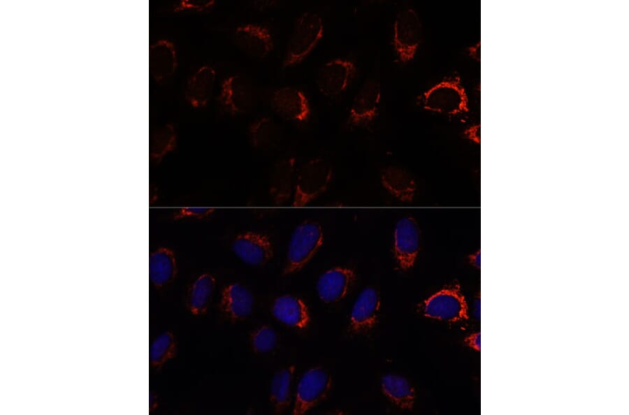 Immunofluorescence - Anti-AP3S2 Antibody (A307442) - Antibodies.com