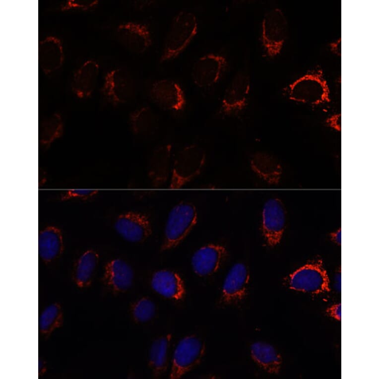 Immunofluorescence - Anti-AP3S2 Antibody (A307442) - Antibodies.com