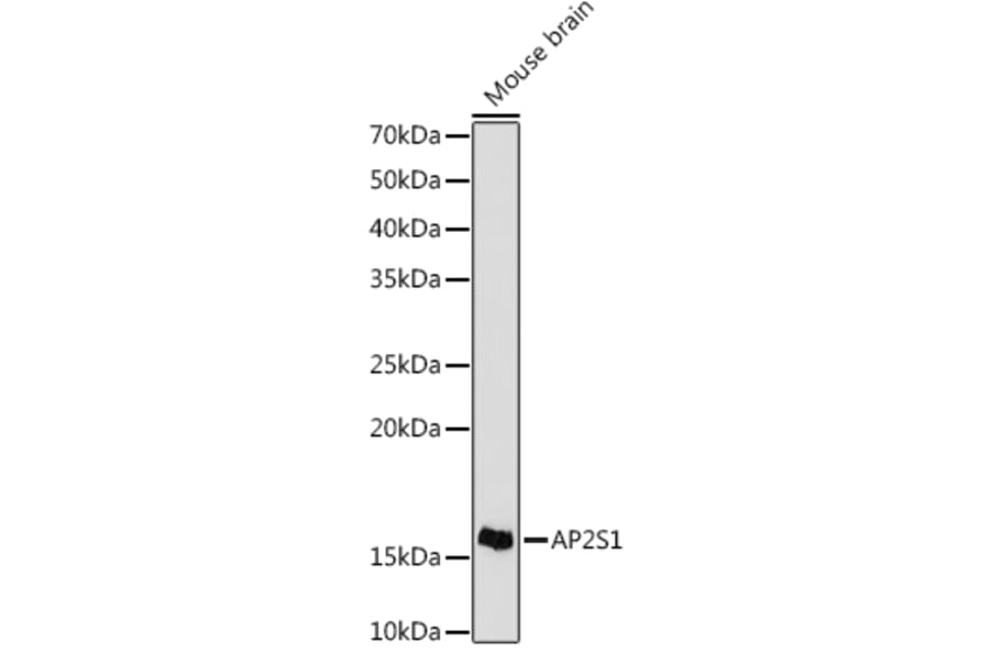 Western Blot - Anti-AP2S1 Antibody [ARC1500] (A307443) - Antibodies.com