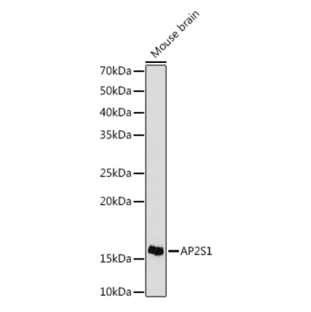 Western Blot - Anti-AP2S1 Antibody [ARC1500] (A307443) - Antibodies.com