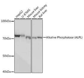 Western Blot - Anti-Alkaline Phosphatase, Tissue Non-Specific Antibody [ARC0245] (A307444) - Antibodies.com
