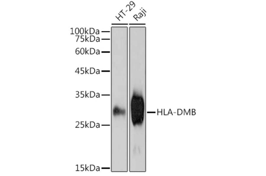 Western Blot - Anti-HLA DMB Antibody [ARC2555] (A307445) - Antibodies.com