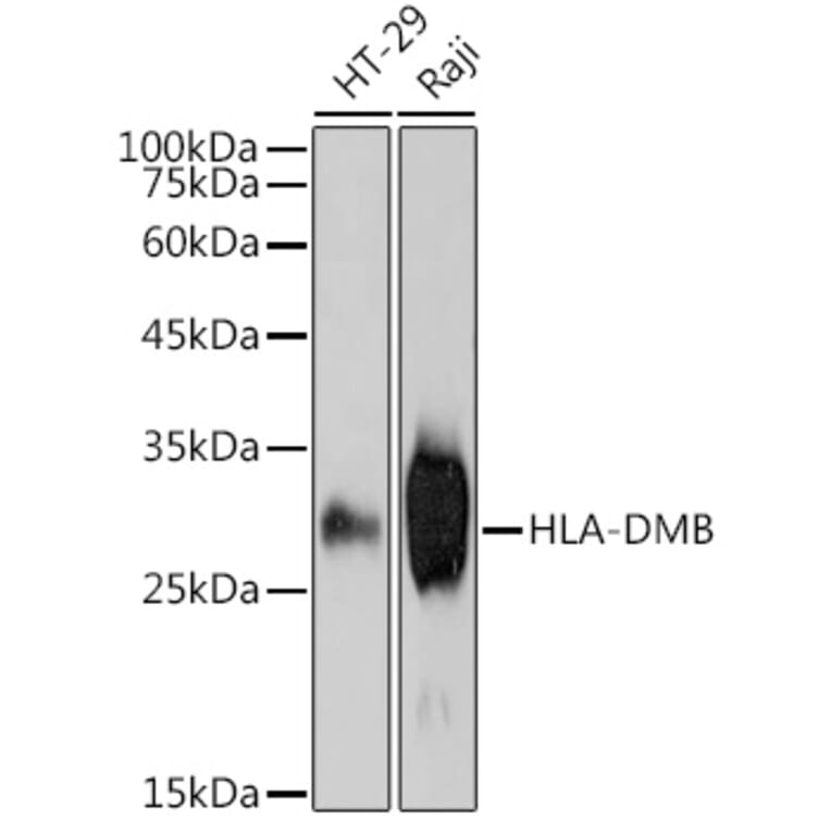 Western Blot - Anti-HLA DMB Antibody [ARC2555] (A307445) - Antibodies.com