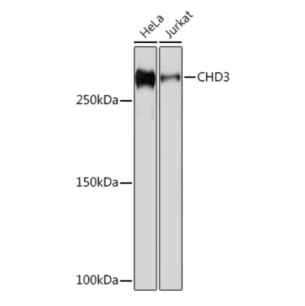 Western Blot - Anti-CHD3 Antibody [ARC1975] (A307446) - Antibodies.com