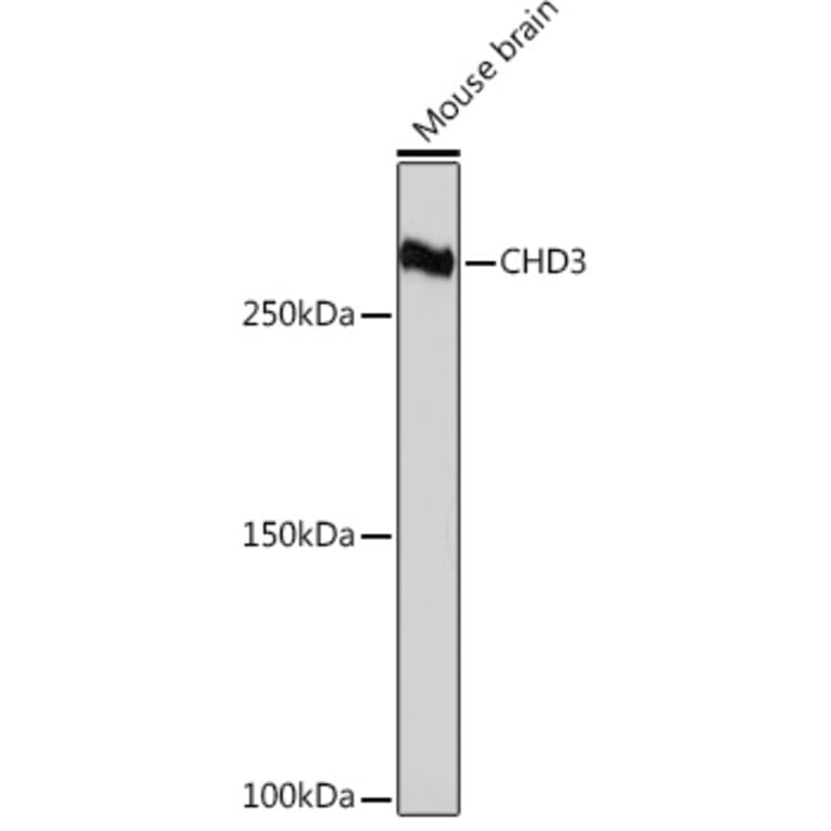Western Blot - Anti-CHD3 Antibody [ARC1975] (A307446) - Antibodies.com