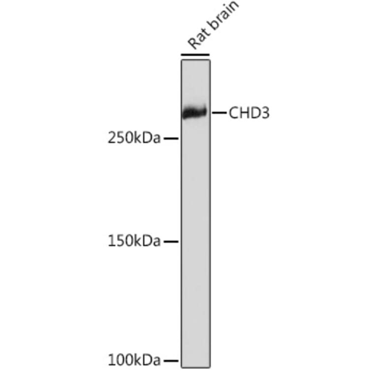 Western Blot - Anti-CHD3 Antibody [ARC1975] (A307446) - Antibodies.com