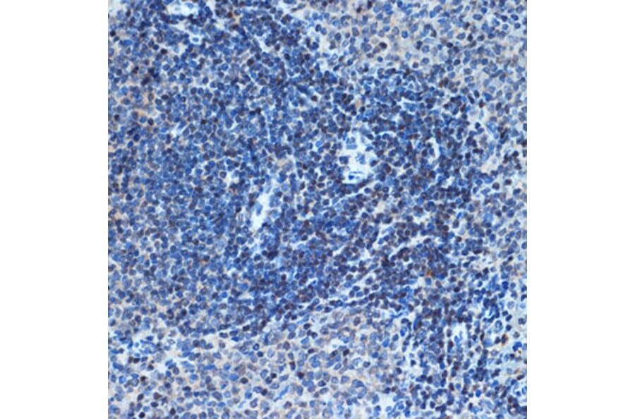 Immunohistochemistry - Anti-CHD3 Antibody [ARC1975] (A307446) - Antibodies.com