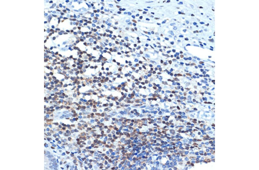 Immunohistochemistry - Anti-CHD3 Antibody [ARC1975] (A307446) - Antibodies.com