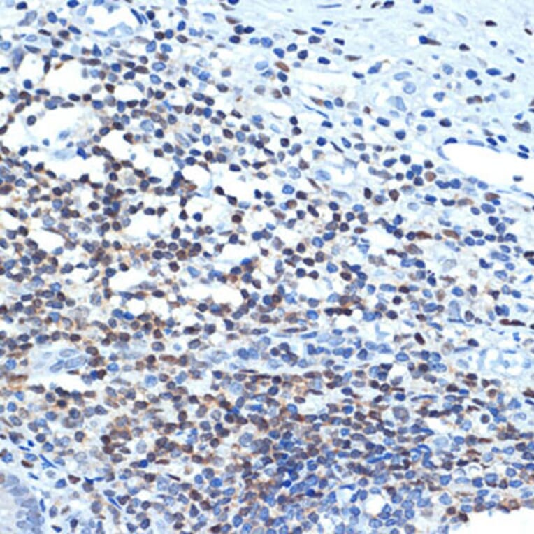 Immunohistochemistry - Anti-CHD3 Antibody [ARC1975] (A307446) - Antibodies.com