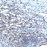 Immunohistochemistry - Anti-CHD3 Antibody [ARC1975] (A307446) - Antibodies.com