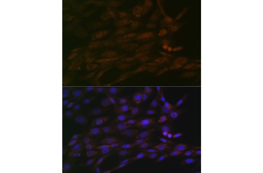 Immunofluorescence - Anti-CHD3 Antibody [ARC1975] (A307446) - Antibodies.com