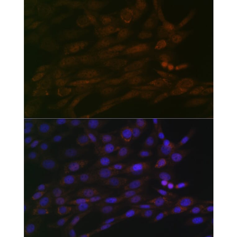 Immunofluorescence - Anti-CHD3 Antibody [ARC1975] (A307446) - Antibodies.com
