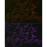 Immunofluorescence - Anti-CHD3 Antibody [ARC1975] (A307446) - Antibodies.com