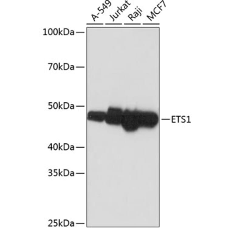 Western Blot - Anti-ETS1 Antibody [ARC0082] (A307447) - Antibodies.com