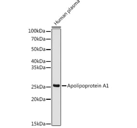 Western Blot - Anti-Apolipoprotein A I Antibody [ARC0911] (A307448) - Antibodies.com