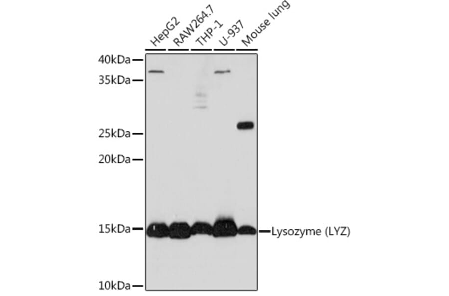 Western Blot - Anti-Lysozyme Antibody [ARC0276] (A307449) - Antibodies.com