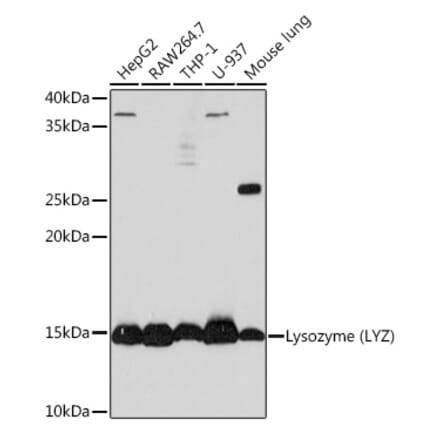 Western Blot - Anti-Lysozyme Antibody [ARC0276] (A307449) - Antibodies.com