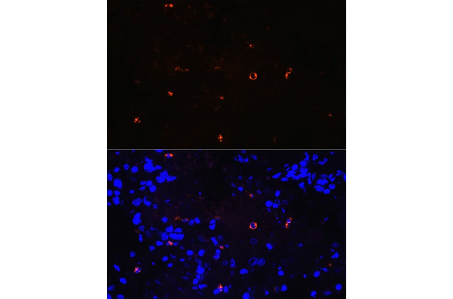 Immunofluorescence - Anti-Lysozyme Antibody [ARC0276] (A307449) - Antibodies.com
