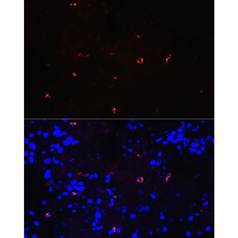 Immunofluorescence - Anti-Lysozyme Antibody [ARC0276] (A307449) - Antibodies.com