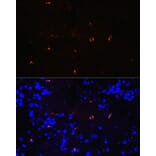 Immunofluorescence - Anti-Lysozyme Antibody [ARC0276] (A307449) - Antibodies.com