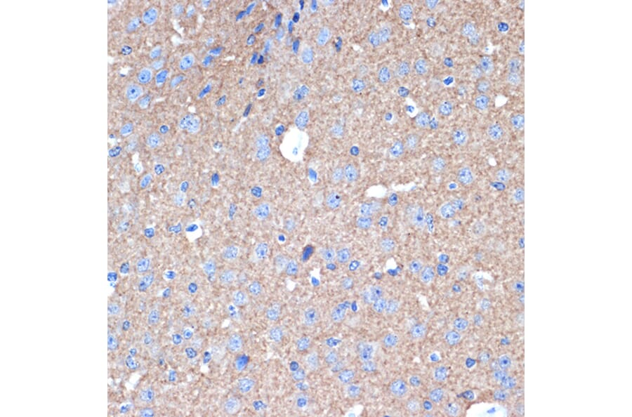 Immunohistochemistry - Anti-Syntaxin 1a Antibody [ARC2403] (A307451) - Antibodies.com
