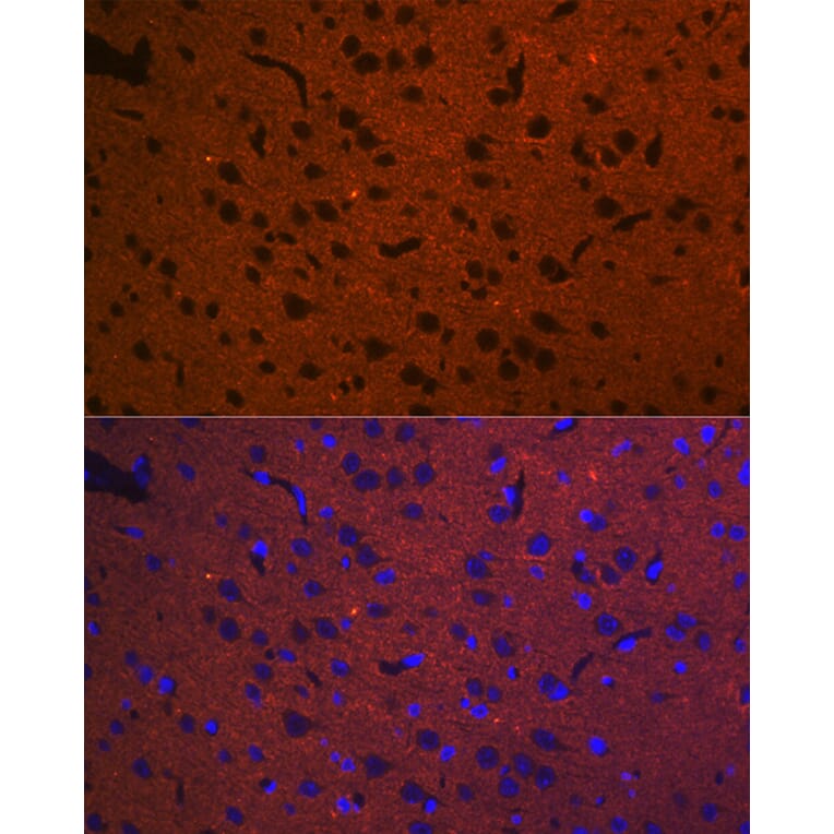Immunofluorescence - Anti-Syntaxin 1a Antibody [ARC2403] (A307451) - Antibodies.com