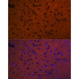 Immunofluorescence - Anti-Syntaxin 1a Antibody [ARC2403] (A307451) - Antibodies.com