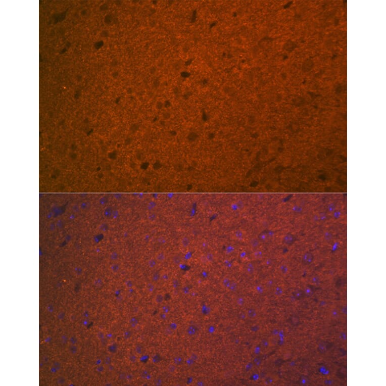 Immunofluorescence - Anti-Syntaxin 1a Antibody [ARC2403] (A307451) - Antibodies.com
