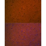 Immunofluorescence - Anti-Syntaxin 1a Antibody [ARC2403] (A307451) - Antibodies.com