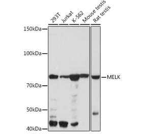Western Blot - Anti-MELK Antibody [ARC2032] (A307452) - Antibodies.com