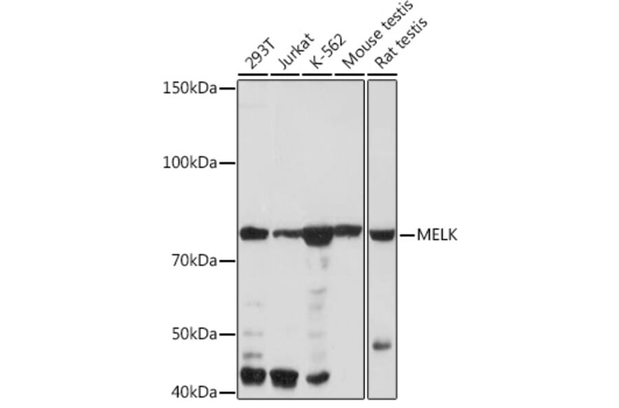 Western Blot - Anti-MELK Antibody [ARC2032] (A307452) - Antibodies.com