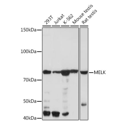 Western Blot - Anti-MELK Antibody [ARC2032] (A307452) - Antibodies.com