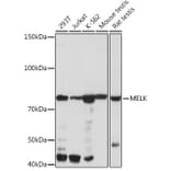 Western Blot - Anti-MELK Antibody [ARC2032] (A307452) - Antibodies.com